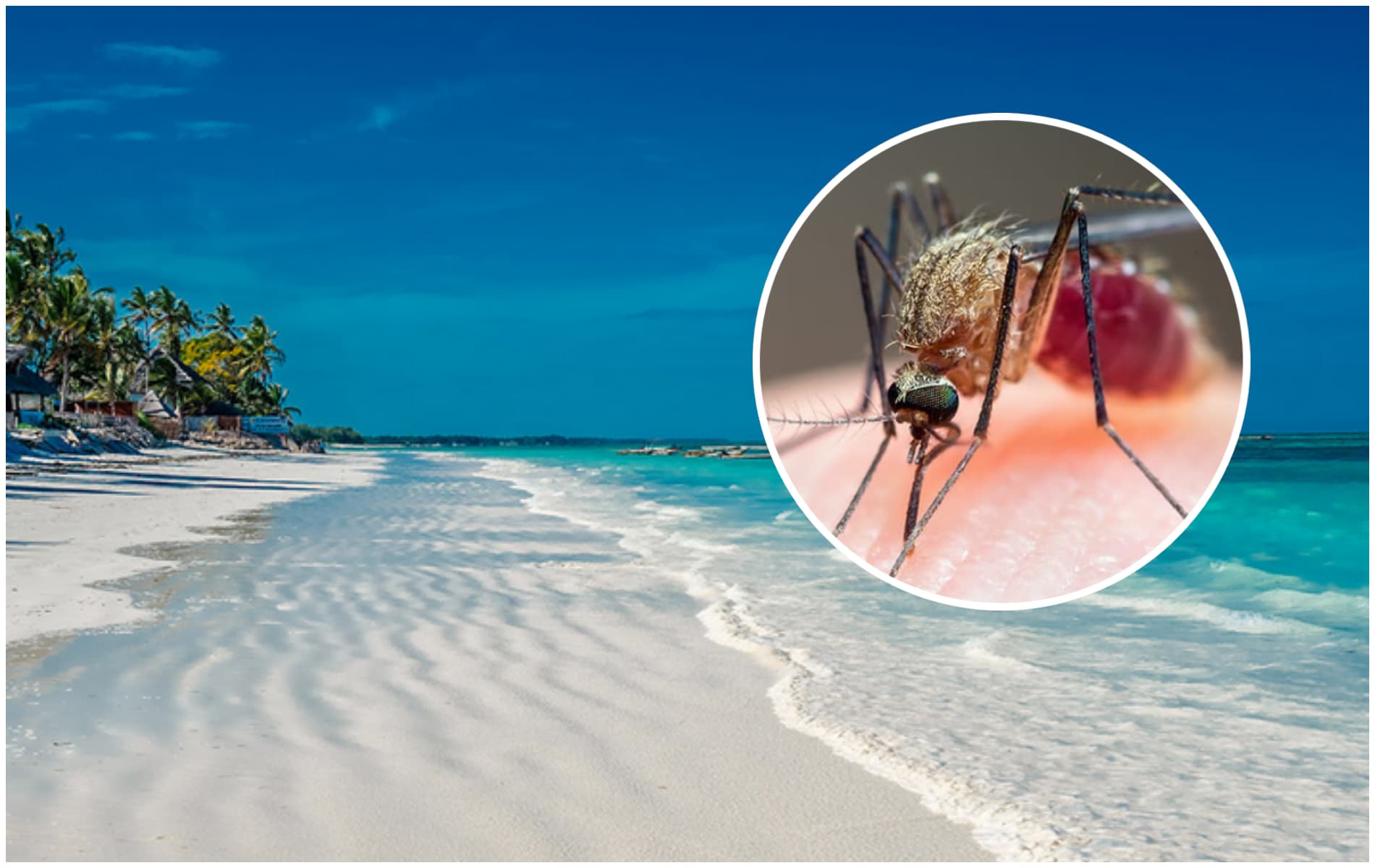Peste 3.500 de cazuri de malarie în Zanzibar. Doi români au murit după ce s-au infectat cu această boală în vacanță